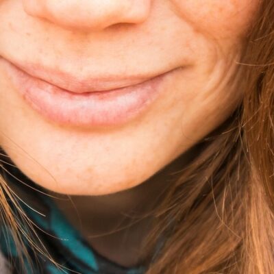 What Can You Do When You’re Self Conscious About Your Smile?